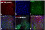 Rabbit IgG (H+L) Cross-Adsorbed Secondary Antibody in Immunocytochemistry (ICC/IF)