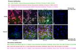 Human IgG (H+L) Cross-Adsorbed Secondary Antibody