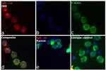 Human IgG (H+L) Cross-Adsorbed Secondary Antibody in Immunocytochemistry (ICC/IF)