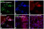 Mouse IgG1 Cross-Adsorbed Secondary Antibody in Immunocytochemistry (ICC/IF)