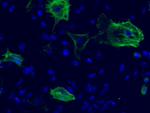 Mouse IgG2a Cross-Adsorbed Secondary Antibody in Immunocytochemistry (ICC/IF)