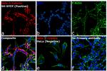 Mouse IgG2a Cross-Adsorbed Secondary Antibody in Immunocytochemistry (ICC/IF)