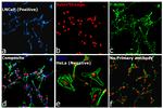 Mouse IgG2b Cross-Adsorbed Secondary Antibody in Immunocytochemistry (ICC/IF)