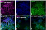 Mouse IgG (H+L) Cross-Adsorbed Secondary Antibody in Immunocytochemistry (ICC/IF)