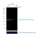 Rat IgG (H+L) Cross-Adsorbed Secondary Antibody in Western Blot (WB)