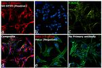 Mouse IgG2a Cross-Adsorbed Secondary Antibody in Immunocytochemistry (ICC/IF)