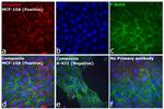 Rabbit IgG (H+L) Cross-Adsorbed Secondary Antibody in Immunocytochemistry (ICC/IF)