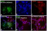 Mouse IgG (H+L) Cross-Adsorbed Secondary Antibody in Immunocytochemistry (ICC/IF)