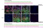 Human IgG (H+L) Cross-Adsorbed Secondary Antibody