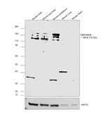 NMDAR2B Antibody in Western Blot (WB)