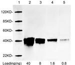 RFP-tag Antibody in Western Blot (WB)