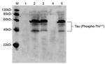 Phospho-Tau (Thr217) Antibody in Western Blot (WB)