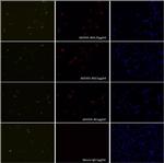 SpCas9 Antibody in Immunocytochemistry (ICC/IF)