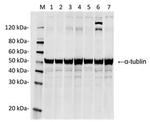 SpCas9 Antibody in Western Blot (WB)