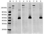 SpCas9 Antibody in Western Blot (WB)