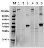 SpCas9 Antibody in Western Blot (WB)