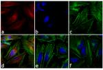 Mouse IgG (H+L) Highly Cross-Adsorbed Secondary Antibody in Immunocytochemistry (ICC/IF)