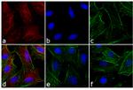 Rat IgG (H+L) Cross-Adsorbed Secondary Antibody in Immunocytochemistry (ICC/IF)