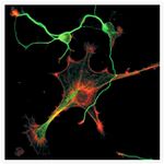 Mouse IgG (H+L) Cross-Adsorbed Secondary Antibody in Immunocytochemistry (ICC/IF)