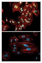 Mouse IgG (H+L) Cross-Adsorbed Secondary Antibody in Immunocytochemistry (ICC/IF)