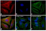 Mouse IgG (H+L) Cross-Adsorbed Secondary Antibody in Immunocytochemistry (ICC/IF)