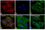 Mouse IgG (H+L) Cross-Adsorbed Secondary Antibody in Immunocytochemistry (ICC/IF)