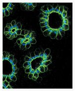 Mouse IgG (H+L) Cross-Adsorbed Secondary Antibody in Immunohistochemistry (IHC)