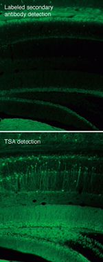 Rabbit IgG (H+L) Cross-Adsorbed Secondary Antibody in Immunohistochemistry (Paraffin) (IHC (P))