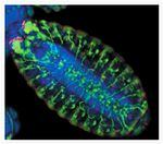 Rabbit IgG (H+L) Cross-Adsorbed Secondary Antibody in Immunocytochemistry (ICC/IF)