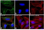 Mouse IgG (H+L) Cross-Adsorbed Secondary Antibody in Immunocytochemistry (ICC/IF)