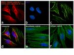 Mouse IgG (H+L) Cross-Adsorbed Secondary Antibody in Immunocytochemistry (ICC/IF)