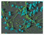 Mouse IgG (H+L) Highly Cross-Adsorbed Secondary Antibody in Immunocytochemistry (ICC/IF)