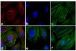 Mouse IgG (H+L) Highly Cross-Adsorbed Secondary Antibody in Immunocytochemistry (ICC/IF)