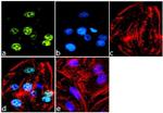 Mouse IgG (H+L) Highly Cross-Adsorbed Secondary Antibody in Immunocytochemistry (ICC/IF)