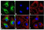 Mouse IgG (H+L) Highly Cross-Adsorbed Secondary Antibody in Immunocytochemistry (ICC/IF)