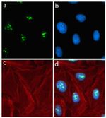 Rabbit IgG (H+L) Highly Cross-Adsorbed Secondary Antibody in Immunocytochemistry (ICC/IF)