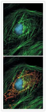 GFP Antibody in Immunocytochemistry (ICC/IF)