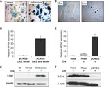 beta Galactosidase Antibody in Western Blot (WB)