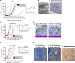 beta Galactosidase Antibody in Immunohistochemistry (Paraffin) (IHC (P))