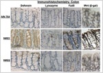 beta Galactosidase Antibody in Immunohistochemistry (IHC)