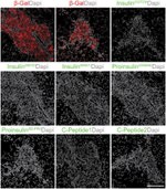 beta Galactosidase Antibody in Immunohistochemistry (IHC)