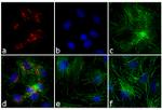 Rabbit IgG (H+L) Secondary Antibody in Immunocytochemistry (ICC/IF)