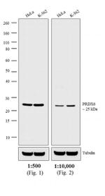 Rabbit IgG (H+L) Cross-Adsorbed Secondary Antibody in Western Blot (WB)