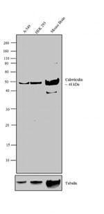 Chicken IgY (H+L) Secondary Antibody in Western Blot (WB)