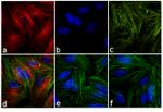 Mouse IgG (H+L) Secondary Antibody in Immunocytochemistry (ICC/IF)