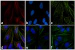 Mouse IgG (H+L) Cross-Adsorbed Secondary Antibody in Immunocytochemistry (ICC/IF)