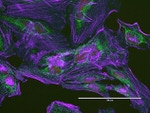 Mouse IgG (H+L) Highly Cross-Adsorbed Secondary Antibody in Immunocytochemistry (ICC/IF)