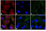 Rabbit IgG (H+L) Secondary Antibody in Immunocytochemistry (ICC/IF)