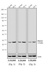 Rabbit IgG (H+L) Highly Cross-Adsorbed Secondary Antibody in Western Blot (WB)