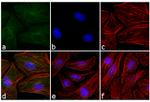 Mouse IgG (H+L) Cross-Adsorbed Secondary Antibody in Immunocytochemistry (ICC/IF)